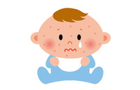 【赤ちゃんの育児】知っておきたいよくかかる病気～「風疹」について